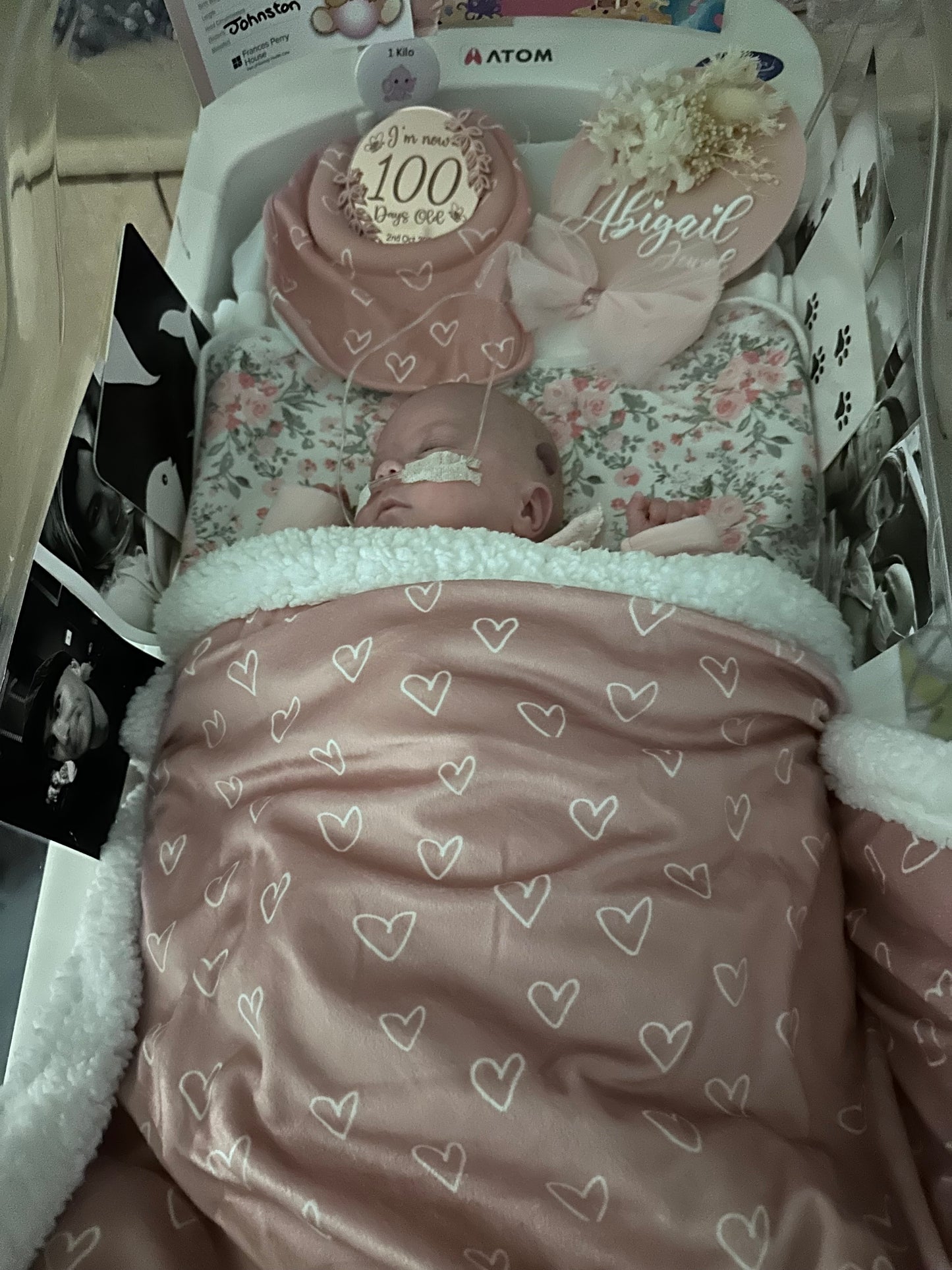 NICU/SCN Milestone discs